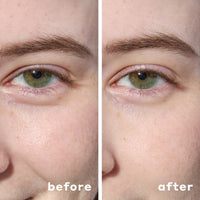 HYDROGEL UNDER EYE PATCHES